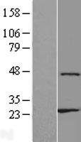 ZNF659 / ZNF385D Protein - Western validation with an anti-DDK antibody * L: Control HEK293 lysate R: Over-expression lysate