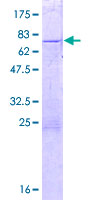 ZNF659 / ZNF385D Protein - 12.5% SDS-PAGE of human ZNF385D stained with Coomassie Blue