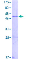 ZNF664 Protein - 12.5% SDS-PAGE of human ZNF664 stained with Coomassie Blue
