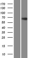 ZNF668 Protein - Western validation with an anti-DDK antibody * L: Control HEK293 lysate R: Over-expression lysate