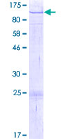 ZNF668 Protein - 12.5% SDS-PAGE of human ZNF668 stained with Coomassie Blue