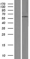 ZNF682 Protein - Western validation with an anti-DDK antibody * L: Control HEK293 lysate R: Over-expression lysate