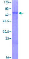 ZNF684 Protein - 12.5% SDS-PAGE of human ZNF684 stained with Coomassie Blue