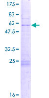 ZNF688 Protein - 12.5% SDS-PAGE of human ZNF688 stained with Coomassie Blue