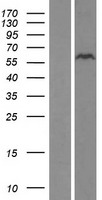 ZNF689 Protein - Western validation with an anti-DDK antibody * L: Control HEK293 lysate R: Over-expression lysate