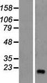 ZNF69 Protein - Western validation with an anti-DDK antibody * L: Control HEK293 lysate R: Over-expression lysate