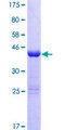 ZNF69 Protein - 12.5% SDS-PAGE of human ZNF69 stained with Coomassie Blue