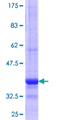ZNF69 Protein - 12.5% SDS-PAGE Stained with Coomassie Blue.