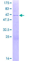 ZNF691 Protein - 12.5% SDS-PAGE of human ZNF691 stained with Coomassie Blue