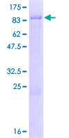 ZNF692 Protein - 12.5% SDS-PAGE of human ZNF692 stained with Coomassie Blue