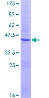 ZNF695 Protein - 12.5% SDS-PAGE of human ZNF695 stained with Coomassie Blue