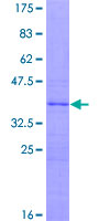 ZNF697 Protein - 12.5% SDS-PAGE of human ZNF697 stained with Coomassie Blue