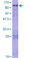 ZNF7 Protein - 12.5% SDS-PAGE of human ZNF7 stained with Coomassie Blue