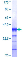 ZNF7 Protein - 12.5% SDS-PAGE Stained with Coomassie Blue