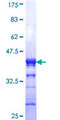 ZNF7 Protein - 12.5% SDS-PAGE Stained with Coomassie Blue