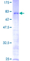 ZNF70 Protein - 12.5% SDS-PAGE of human ZNF70 stained with Coomassie Blue