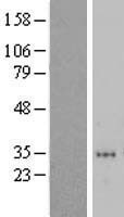 ZNF705D Protein - Western validation with an anti-DDK antibody * L: Control HEK293 lysate R: Over-expression lysate