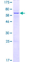 ZNF707 Protein - 12.5% SDS-PAGE of human ZNF707 stained with Coomassie Blue