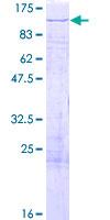 ZNF710 Protein - 12.5% SDS-PAGE of human ZNF710 stained with Coomassie Blue