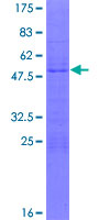ZNF747 Protein - 12.5% SDS-PAGE of human MGC2474 stained with Coomassie Blue