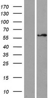 ZNF75 / ZNF75D Protein - Western validation with an anti-DDK antibody * L: Control HEK293 lysate R: Over-expression lysate
