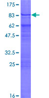 ZNF75 / ZNF75D Protein - 12.5% SDS-PAGE of human ZNF75 stained with Coomassie Blue
