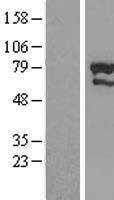 ZNF76 Protein - Western validation with an anti-DDK antibody * L: Control HEK293 lysate R: Over-expression lysate