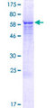 ZNF764 Protein - 12.5% SDS-PAGE of human ZNF764 stained with Coomassie Blue