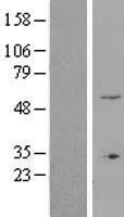 ZNF77 Protein - Western validation with an anti-DDK antibody * L: Control HEK293 lysate R: Over-expression lysate