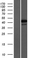 ZNF771 Protein - Western validation with an anti-DDK antibody * L: Control HEK293 lysate R: Over-expression lysate