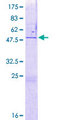 ZNF771 Protein - 12.5% SDS-PAGE of human ZNF771 stained with Coomassie Blue