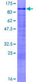 ZNF777 Protein - 12.5% SDS-PAGE of human KIAA1285 stained with Coomassie Blue