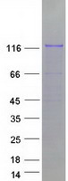 ZNF777 Protein - Purified recombinant protein ZNF777 was analyzed by SDS-PAGE gel and Coomassie Blue Staining