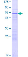 ZNF781 Protein - 12.5% SDS-PAGE of human ZNF781 stained with Coomassie Blue