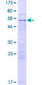 ZNF781 Protein - 12.5% SDS-PAGE of human ZNF781 stained with Coomassie Blue