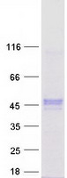 ZNF784 Protein - Purified recombinant protein ZNF784 was analyzed by SDS-PAGE gel and Coomassie Blue Staining