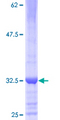 ZNF789 Protein - 12.5% SDS-PAGE of human LOC285989 stained with Coomassie Blue