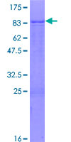 ZNF79 Protein - 12.5% SDS-PAGE of human ZNF79 stained with Coomassie Blue