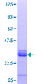 ZNF79 Protein - 12.5% SDS-PAGE Stained with Coomassie Blue.