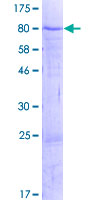 ZNF792 Protein - 12.5% SDS-PAGE of human ZNF792 stained with Coomassie Blue