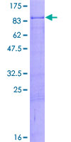 ZNF8 Protein - 12.5% SDS-PAGE of human ZNF8 stained with Coomassie Blue