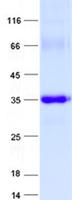 ZNF80 Protein