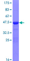 ZNF81 Protein - 12.5% SDS-PAGE of human ZNF81 stained with Coomassie Blue
