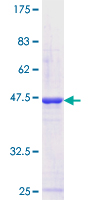 ZNF81 Protein - 12.5% SDS-PAGE Stained with Coomassie Blue.