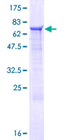 ZNF821 Protein - 12.5% SDS-PAGE of human ZNF821 stained with Coomassie Blue