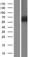 ZNF829 Protein - Western validation with an anti-DDK antibody * L: Control HEK293 lysate R: Over-expression lysate