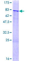 ZNF83 / HPF1 Protein - 12.5% SDS-PAGE of human ZNF83 stained with Coomassie Blue