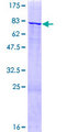 ZNF83 / HPF1 Protein - 12.5% SDS-PAGE of human ZNF83 stained with Coomassie Blue