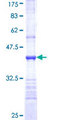 ZNF83 / HPF1 Protein - 12.5% SDS-PAGE Stained with Coomassie Blue.