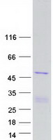 ZNF830 / CCDC16 Protein - Purified recombinant protein ZNF830 was analyzed by SDS-PAGE gel and Coomassie Blue Staining